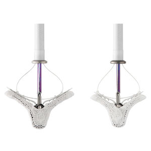 mitral valve cardiac restoration system