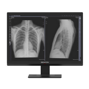 high-definition display