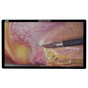 surgical display