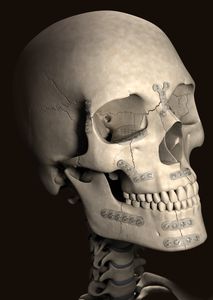 absorbable cranial fixation system