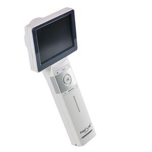 video otoscope