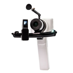 digital slit lamp