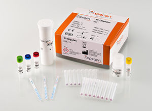 rapid trichomoniasis test