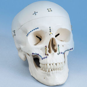 maxillofacial compression plate 1