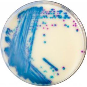 medium reagent