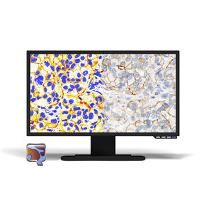 immunohistochemistry software module