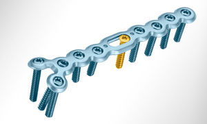 ulna compression plate