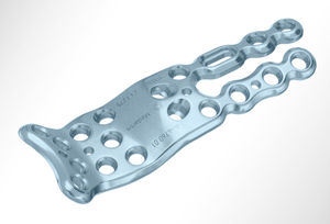 carpal joint arthrodesis plate