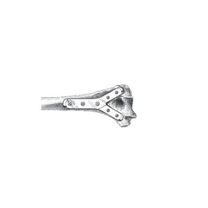 humerus compression plate