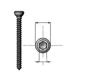 general purpose compression bone screw