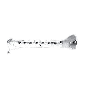 femoral compression plate 1