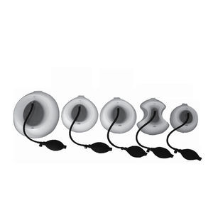 pectus excavatum treatment vacuum bell