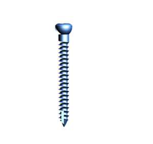 sacro-iliac joint compression bone screw 1