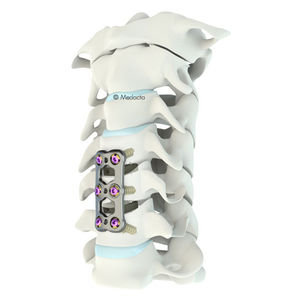 cervical arthrodesis plate