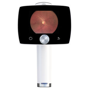 non-mydriatic retinal camera