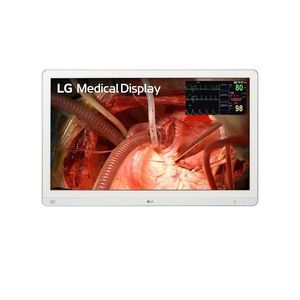 endoscopy display