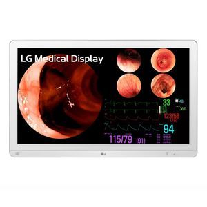 endoscopy display