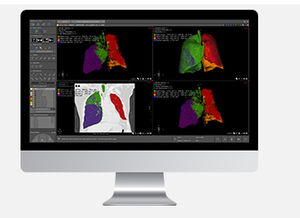 radiology software module
