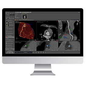 cardiology software module