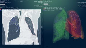 radiology software module