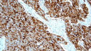 antibody 1