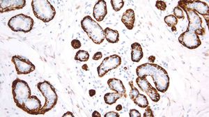 antibody 1