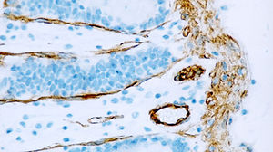monoclonal antibody 1
