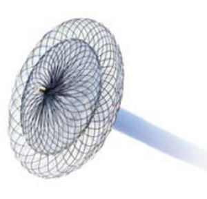 foramen ovale closure occlusion device