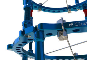 modular external fixation system