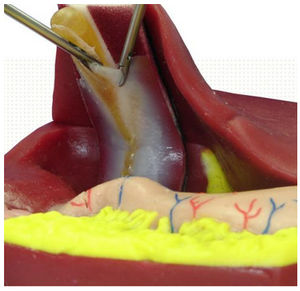 biliary vesicle anatomical model / for cholecystectomy