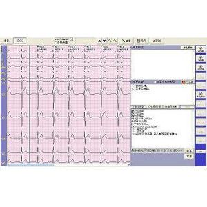 electrocardiography software