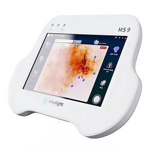 video dermatoscope