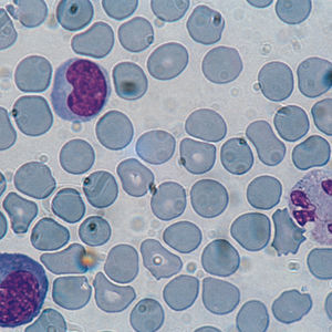 stain reagent 1