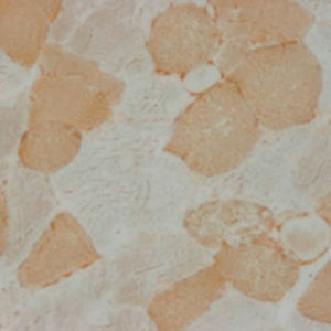 staining solution reagent 1