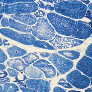 staining solution reagent 1