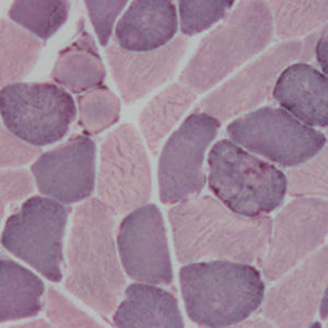 staining solution reagent 1