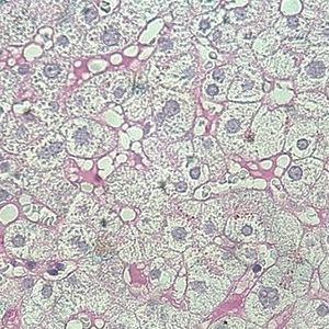 staining solution reagent 1