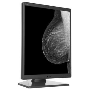 mammography display