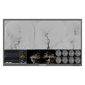 surgical display