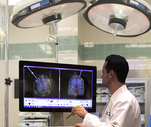 neurosurgery surgical navigation system