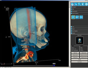 medical imaging software module