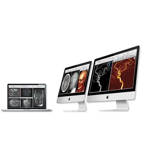 Post-processing software - aycan Medical Systems - 3D viewing / diagnostic / evaluation