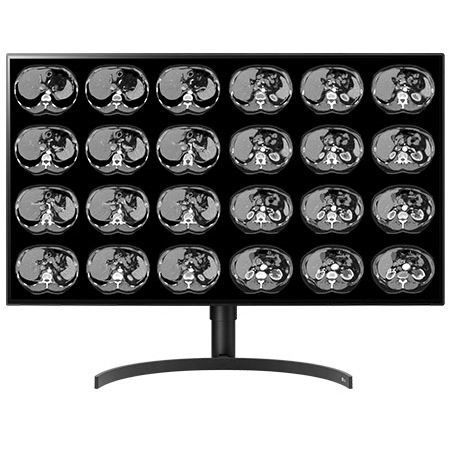 Medical display - CL8MPS32C - Double Black Imaging - diagnostic / 3840 × 2160 / 32"