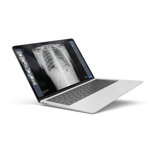 Radiography software - ExamVue Duo - JPI Healthcare Solutions - analysis / management / diagnostic