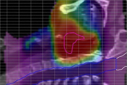Analysis software - ScandiDos - treatment / verification / medical
