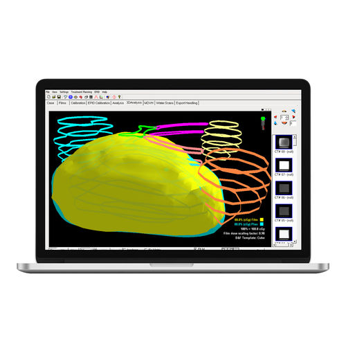 Analysis software - RAy™ - Standard Imaging - radiation dose monitoring / treatment planning / import