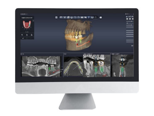 Planning software - Dentiq Guide - 3D Industrial Imaging, Co., Ltd. - data management / design / scan