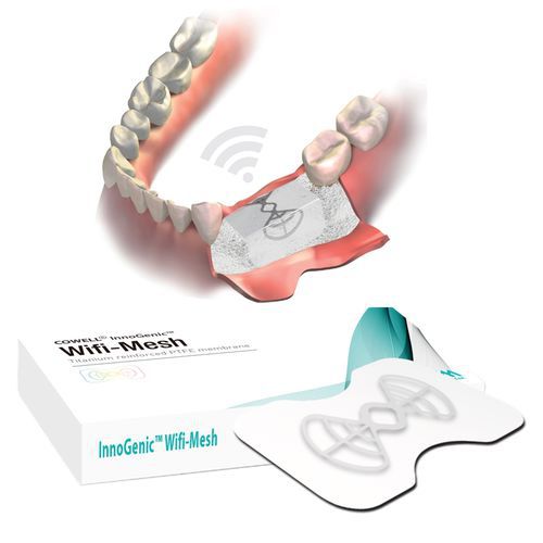 Buccal tissue matrix - InnoGenic™ Wifi-Mesh - Cowellmedi - PTFE