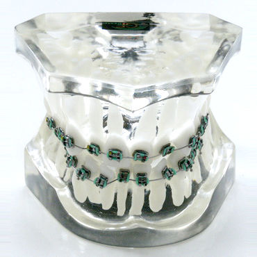 Denture model - OTB2 - GF DENTAL - for orthodontics / training / resin