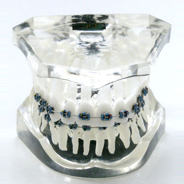 Denture model - OTB3 - GF DENTAL - for orthodontics / training / resin